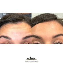 Load image into Gallery viewer, BOO-TOX + Vampire Facial Appointment Deposit
