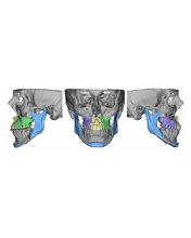 Load image into Gallery viewer, Orthognathic (Jaw Surgery) Consultation Fee
